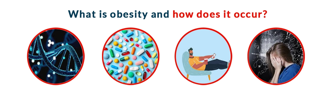 What is Obesity and How Does It Occur